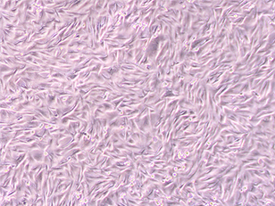 OCM1A（人低侵襲性脈絡(luò)膜黑色素瘤細(xì)胞）